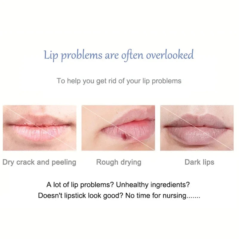 Baume Lèvres Exfoliant Éclaircissant Anti-Mélanine – Hydratant & Réparateur – CLEVI Paris