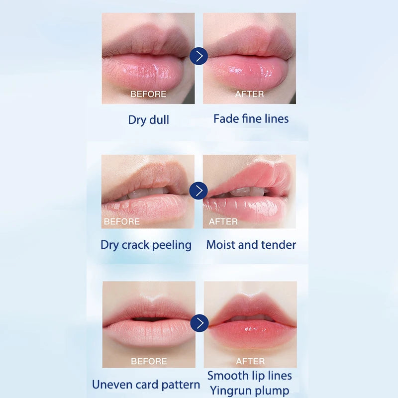 Baume Lèvres Vaseline JETTING – Hydratant, Anti-Gérures & Longue Tenue – CLEVI Paris