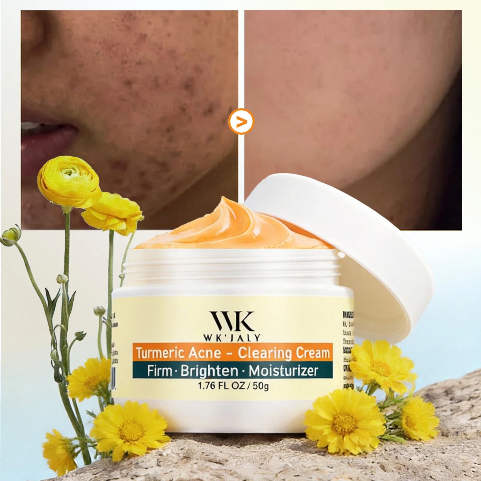 Crème Visage Curcuma Anti-Acné WK'JALY – Éclaircissante, Niacinamide & Aloé Vera 50ml – CLEVI Paris