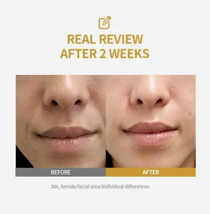Sérum Anti-Rides & Anti-Rides Peptides de Soie – Soin Visage Lissant & Hydratant – CLEVI Paris