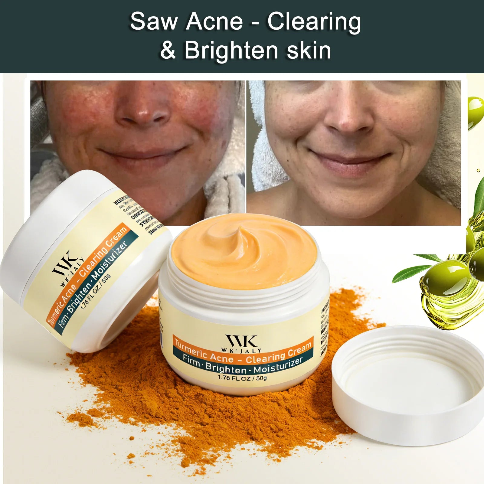 Crème Visage Curcuma Anti-Acné WK'JALY – Éclaircissante, Niacinamide & Aloé Vera 50ml – CLEVI Paris