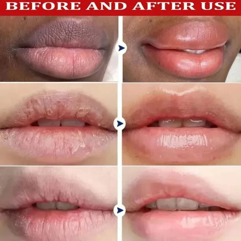 Masque Lèvres Niacinamide Éclaircissant eelhoe – Exfoliant, Anti-Taches & Hydratant – CLEVI Paris